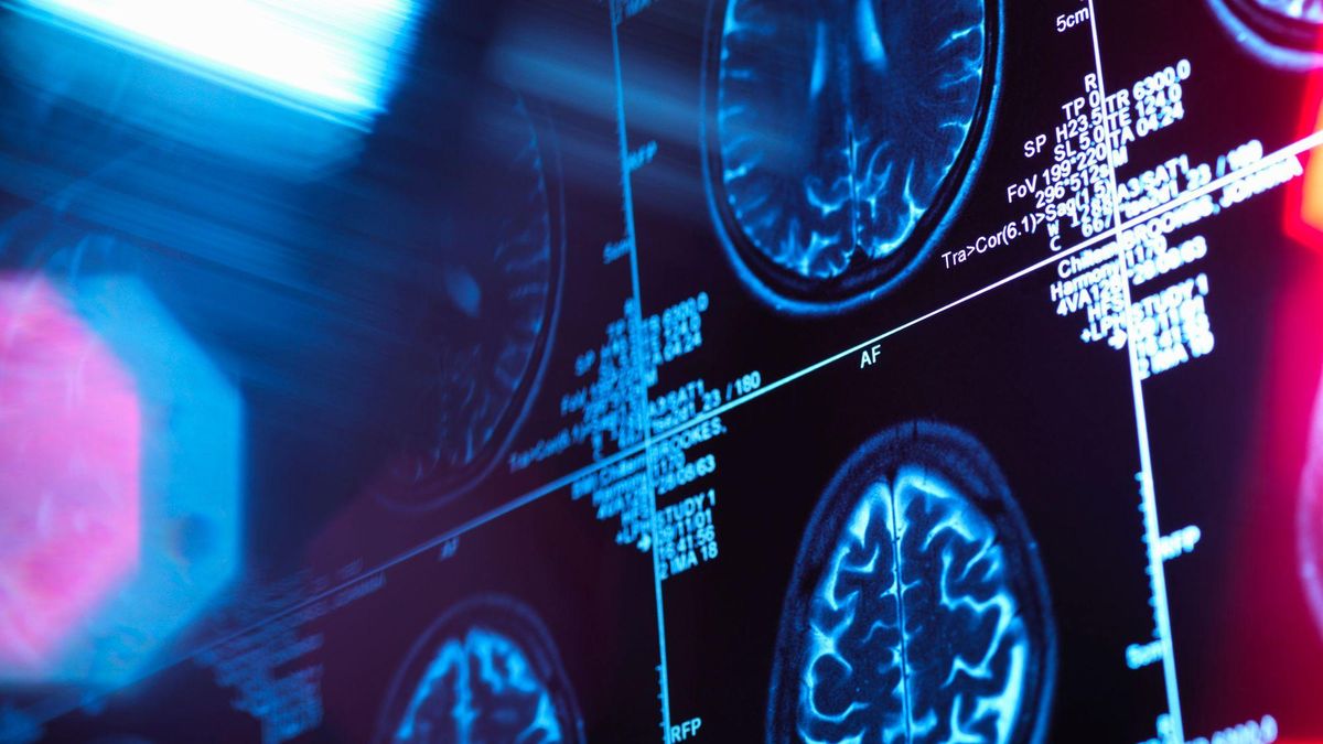 El hábito diario que reduce un 18% el riesgo de demencia